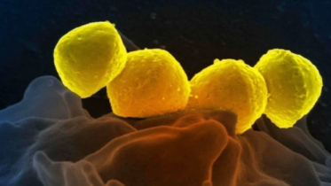 জাপানে ছড়িয়ে পড়েছে ভয়াবহ ব্যাকটেরিয়া, মৃত্যু হতে পারে ৪৮ ঘণ্টায়! জাপানে ছড়িয়ে পড়েছে ভয়াবহ ব্যাকটেরিয়া, মৃত্যু হতে পারে ৪৮ ঘণ্টায়!